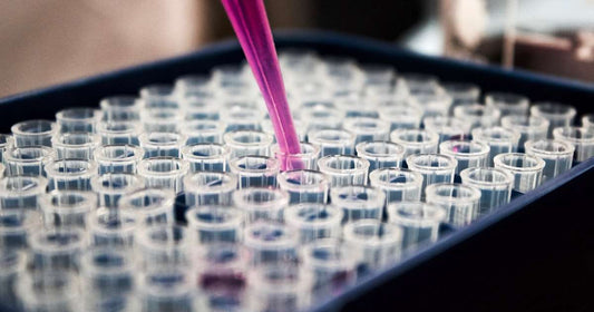 Análisis de sangre con los niveles de colesterol HDL elevado y el perfil lipídico completo