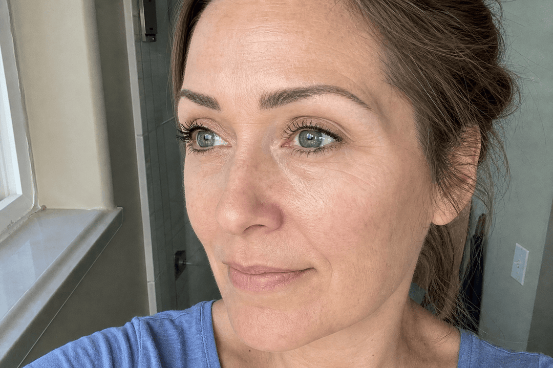 Después de 60 días usando el colágeno de The Everyday Lab — zona de los ojos
